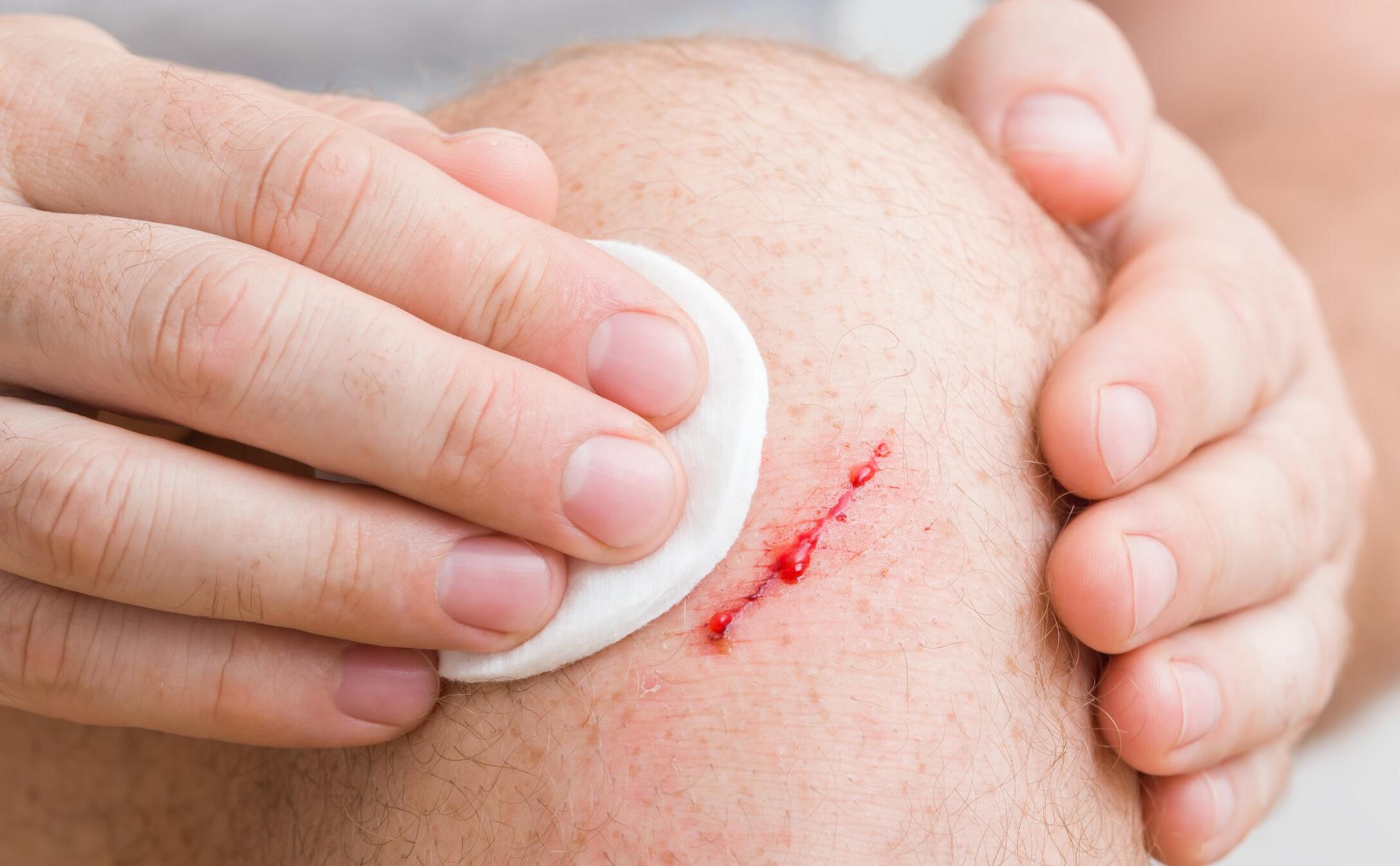 τραυματισμός στο γόνατο